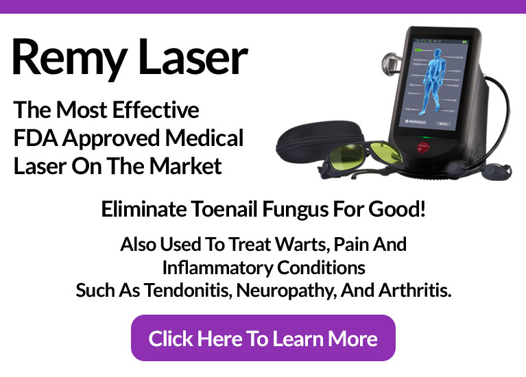 remy laser banner