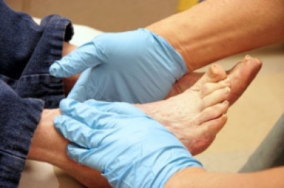 The Role of Caregivers in Diabetic Foot Care